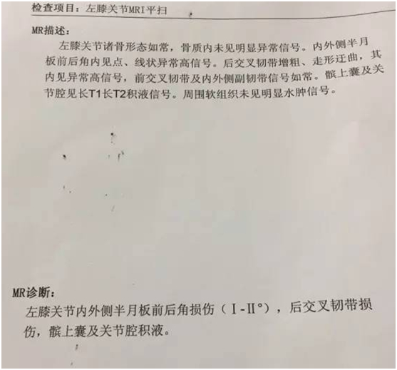▲图片为医院诊断结果：左膝关节内外侧半月板前后角损伤（二度），后交叉韧带损伤，髌上囊及关节腔积液。医院建议，关节镜半月板修复术治疗。
