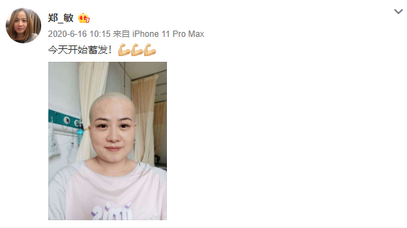 岳云鹏老婆术后9个月复查发文感慨要活的尽兴曾为治病剃光头