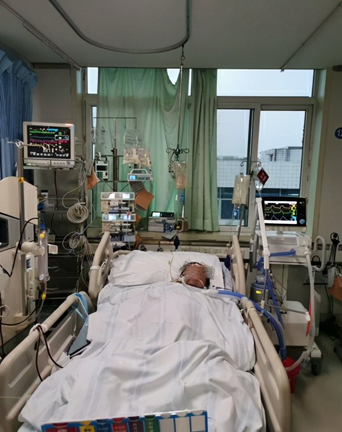 插管呼吸机有什么痛苦每天二两白酒,喝出多器官衰竭!33天才出ICU_新闻资讯_第3张_活检穿刺产品网 插管呼吸机有什么痛苦每天二两白酒,喝出多器官衰竭!33天才出ICU_https://www.jmylbn.com_新闻资讯_第3张