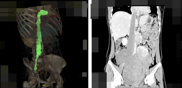 光片图（央广网发 谭又铭摄）