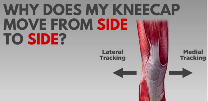 固定膝盖矫正器叫什么为什么膝盖骨左右移动:关于髌骨不稳和脱位_新闻资讯_第1张_活检穿刺产品网 固定膝盖矫正器叫什么为什么膝盖骨左右移动:关于髌骨不稳和脱位_https://www.jmylbn.com_新闻资讯_第1张