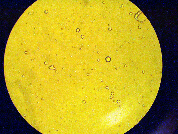 这是在太空实验的一种抗生素，这种抗生素被认为对抗深度肺炎传染有更好的效果。