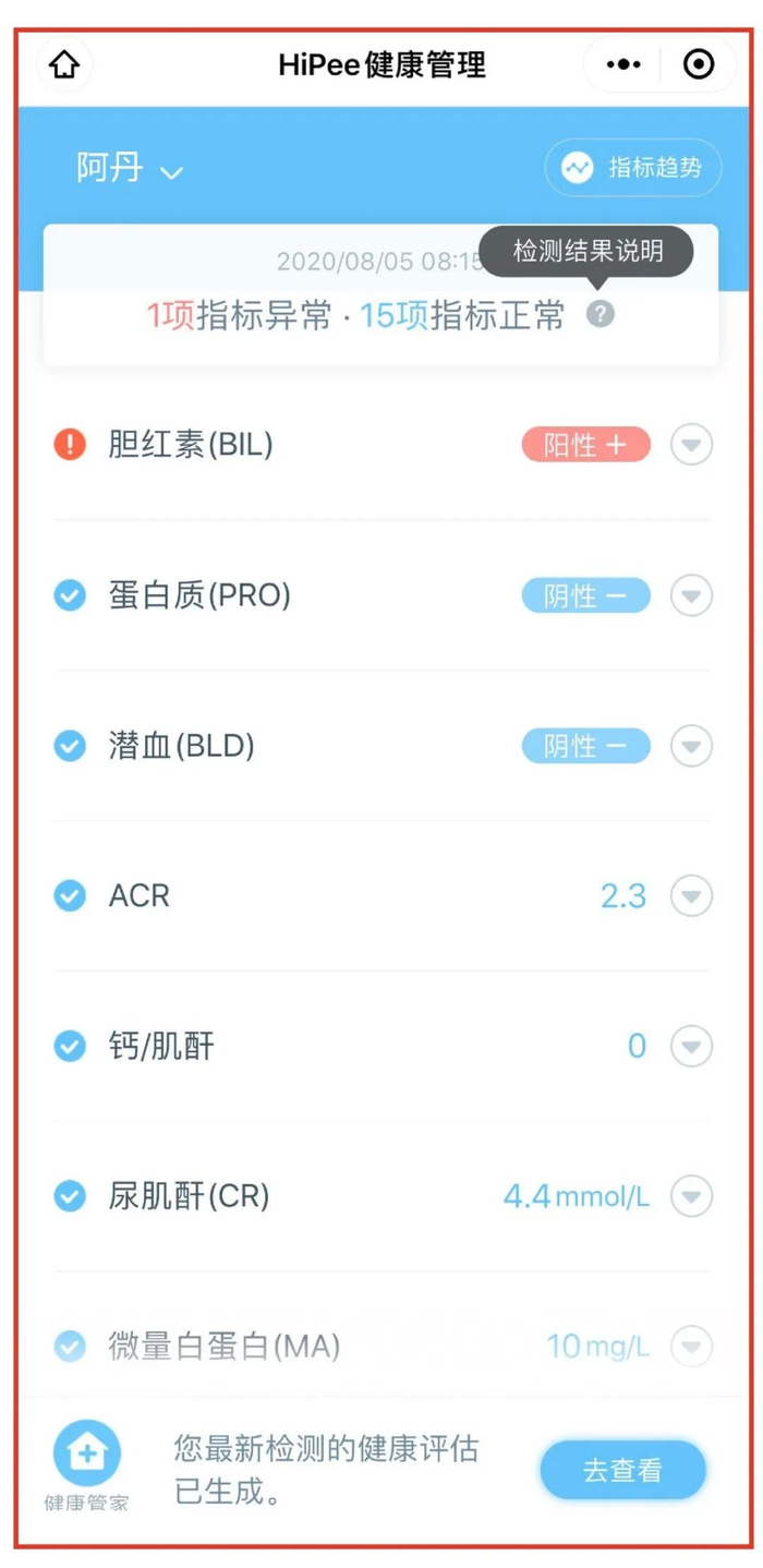 医院尿检仪器怎么卖【肾上线严选】肾友必备居家神器,在家就能轻松检测尿常规_新闻资讯_第6张_活检穿刺产品网 医院尿检仪器怎么卖【肾上线严选】肾友必备居家神器,在家就能轻松检测尿常规_https://www.jmylbn.com_新闻资讯_第6张