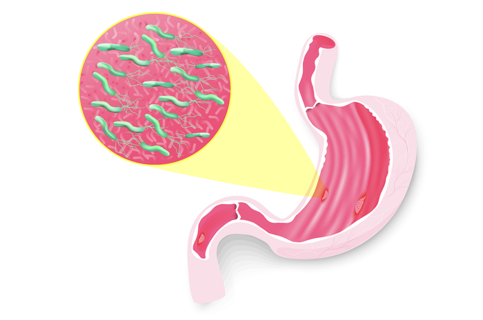 （幽门螺杆菌示意图，受访单位供图）