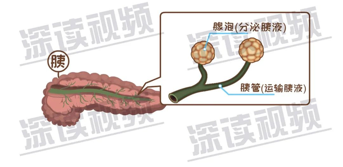 胰腺为啥发炎？致死腹痛背后真相是啥？胰腺炎发病机制动漫版！