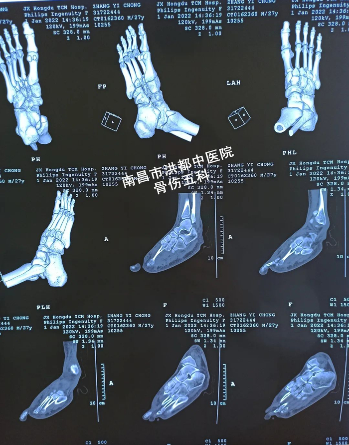 农村围墙倒塌砸到别属于谁的责任