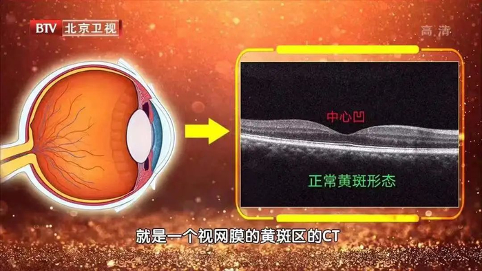 肋骨怎么记忆老而不衰！这张从头到脚的“减龄计划表”请收好，现在开始“冻龄”_https://www.jmylbn.com_新闻资讯_第4张
