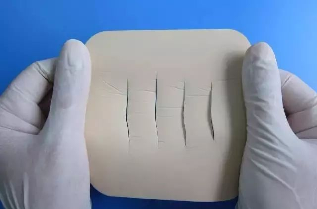 伤口贴敷料为什么ICU预防压疮敷料粘贴技巧大全,值得收藏!_新闻资讯_第13张_活检穿刺产品网 伤口贴敷料为什么ICU预防压疮敷料粘贴技巧大全,值得收藏!_https://www.jmylbn.com_新闻资讯_第13张