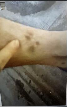 袁小虎向记者展示自己左小腿被电棍灼伤的痕迹