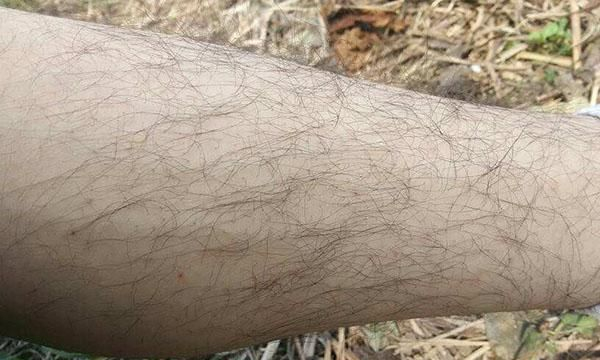 人体的体毛有什么作用？刮掉体毛对身体有什么影响？告诉你答案
