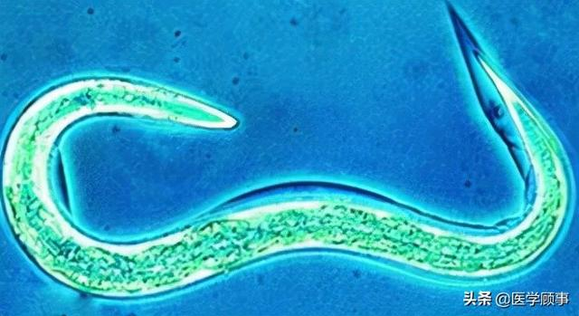 1米长龙线虫入侵人体,曾让350万人痛苦不堪!几天...