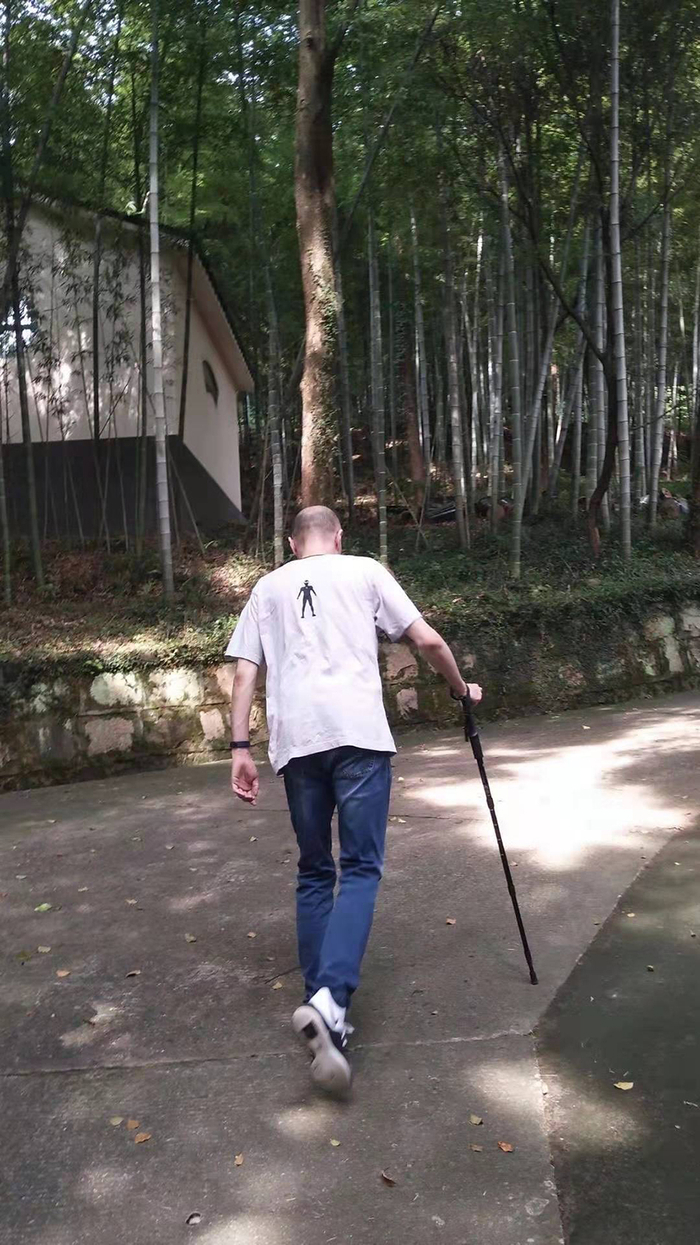 今年43岁的刘轩飞，如今出行离不开一根拐杖。