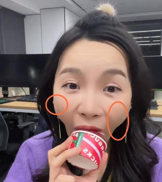 小贝饿了催吐风波后又陷入整容,打玻尿酸如今状态好疲惫