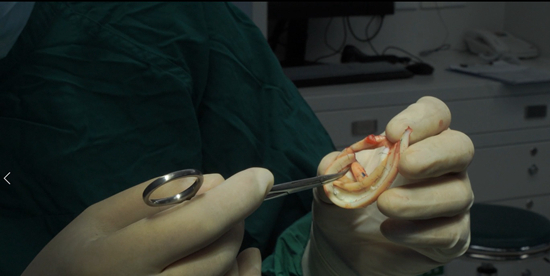 &nbsp;&nbsp;&nbsp;&nbsp;郭树忠在讲解外耳的解剖学结构。&nbsp;受访者供图