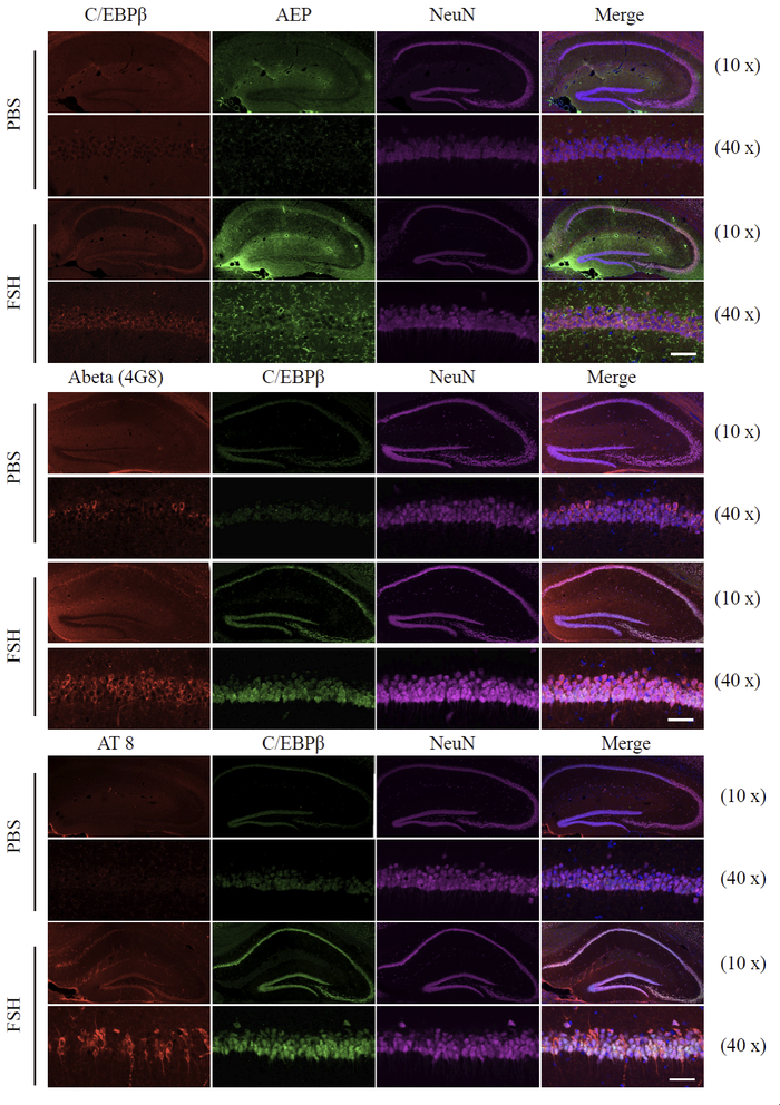 图说：外源性FSH引起C/EBPβ/AEP途径激活研究团队供图