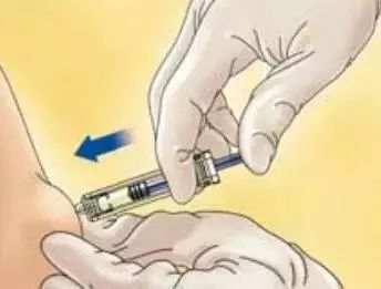 打肝素怎么拔针皮下注射低分子肝素钙问题大总结_新闻资讯_第3张_活检穿刺产品网 打肝素怎么拔针皮下注射低分子肝素钙问题大总结_https://www.jmylbn.com_新闻资讯_第3张