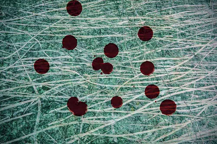 2021年04月14日  宁波    青年人打架后留下的血迹。