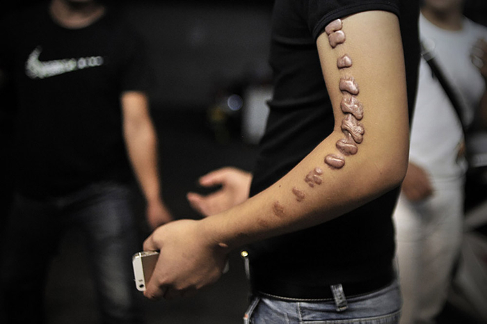 2016年09月17日  宁波   手臂上的印记是楚霄最疼痛的回忆。