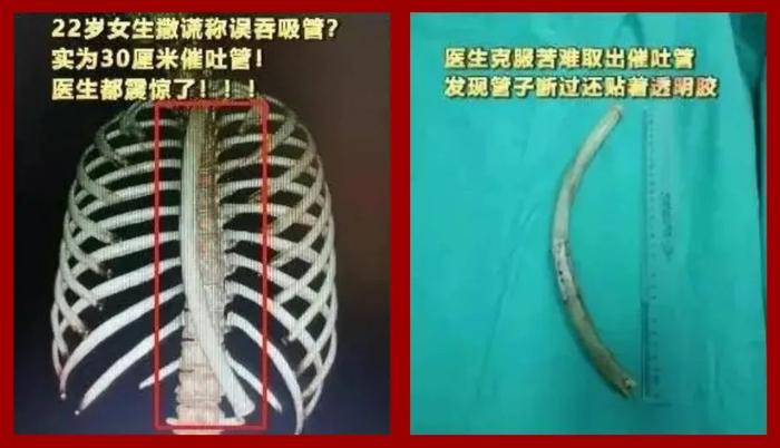 远红外乳腺贴是什么6个专骗女孩的智商税，坑钱还要命_https://www.jmylbn.com_新闻资讯_第17张