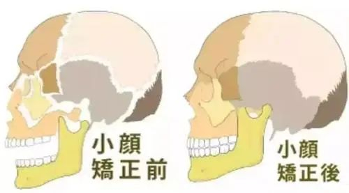 远红外乳腺贴是什么6个专骗女孩的智商税,坑钱还要命_新闻资讯_第13张_活检穿刺产品网 远红外乳腺贴是什么6个专骗女孩的智商税,坑钱还要命_https://www.jmylbn.com_新闻资讯_第13张