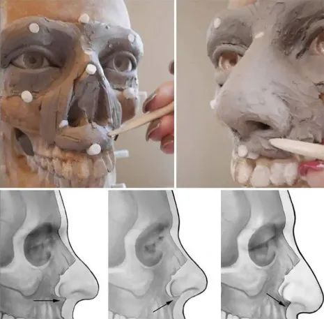 根据头骨还原人脸