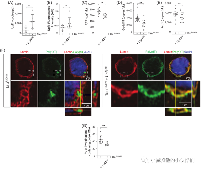 无义介导mRNA降解缺陷是Tau相关神经退行性变的治疗靶标