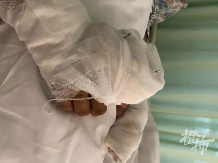 为什么手术要这么多剪刀“我先生拿着修花枝的剪刀，和野猪进行了一场殊死搏斗……”闯进桃源小镇的大野猪撞断铁栏杆，50多岁男业主被咬得鲜血淋漓_https://www.jmylbn.com_新闻资讯_第6张