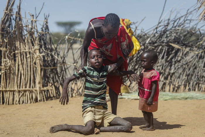 当地时间2022年5月12日，肯尼亚Lomoputh，一位母亲扶着营养不良的儿子站起来。