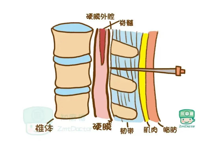 什么全麻机全麻手术会不会变傻?麻醉时经历了什么?_新闻资讯_第10张_活检穿刺产品网 什么全麻机全麻手术会不会变傻?麻醉时经历了什么?_https://www.jmylbn.com_新闻资讯_第10张