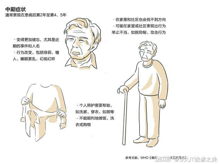 图5. 阿尔茨海默病的中期症状