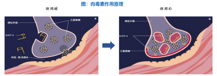 （图源：东吴证券研究所）