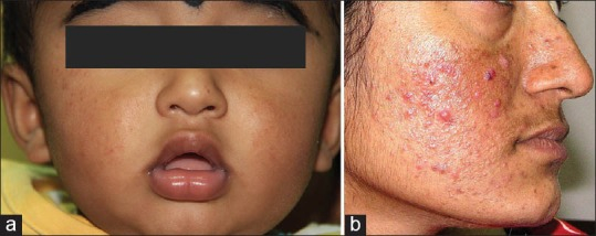 安全保湿霜怎么选?(附品牌推荐)