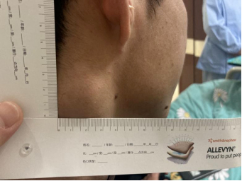 图自微信公众号“杭州市红十字会医院”