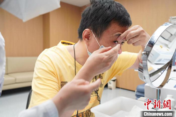 金晓宇佩戴隐形眼镜。　浙大二院供图