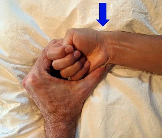 什么叫桡鞘“我,40岁,手术后再也提不起裤子”_新闻资讯_第2张_活检穿刺产品网 什么叫桡鞘“我,40岁,手术后再也提不起裤子”_https://www.jmylbn.com_新闻资讯_第2张