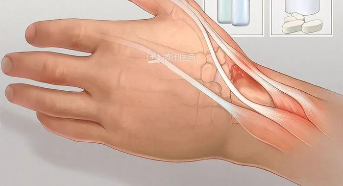 什么叫桡鞘“我,40岁,手术后再也提不起裤子”_新闻资讯_第13张_活检穿刺产品网 什么叫桡鞘“我,40岁,手术后再也提不起裤子”_https://www.jmylbn.com_新闻资讯_第13张