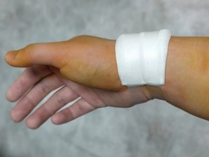 什么叫桡鞘“我，40岁，手术后再也提不起裤子”_https://www.jmylbn.com_新闻资讯_第4张