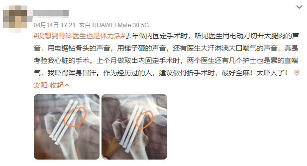 手术电钻怎么用为啥骨科医生的尽头,都成了又帅又多金的渣男?_新闻资讯_第13张_活检穿刺产品网 手术电钻怎么用为啥骨科医生的尽头,都成了又帅又多金的渣男?_https://www.jmylbn.com_新闻资讯_第13张