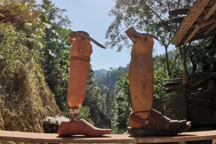 贫困户李万廷的假肢