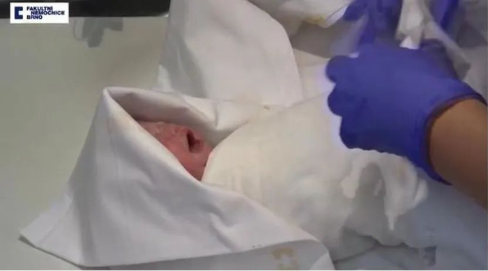 （视频图片来源：捷克布尔诺大学医院）