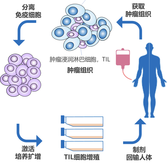 TIL细胞疗法的流程示意图。