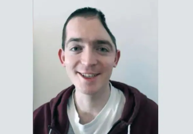 28岁的年轻人虽然保住性命，但失去了半个头骨 &nbsp; ITV News截图