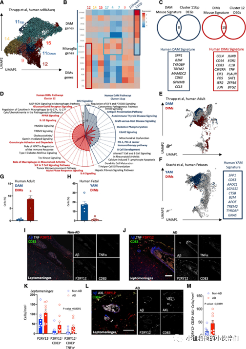 小鼠脑定位怎么固定Immunity：细分大脑巨噬细胞亚群_https://www.jmylbn.com_新闻资讯_第7张