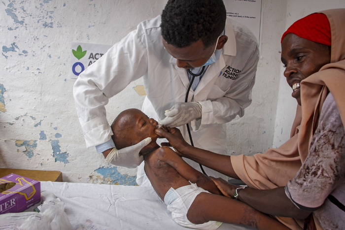 当地时间2022年6月5日，索马里摩加迪沙，医生正在治疗营养不良的孩子。