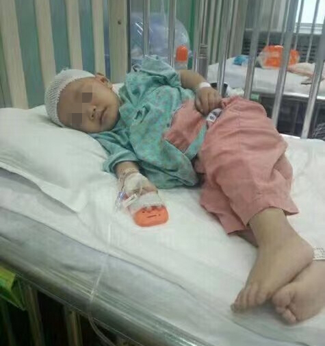 馨馨在治疗中。