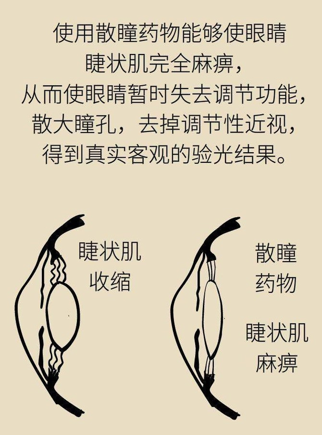 关于散瞳验光，您想知道的都在这里！送上散瞳验光小贴士|近视|远视|视力|岳阳市|眼科_新浪新闻
