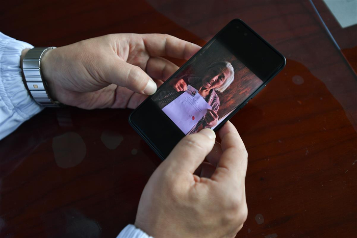 奶奶从老家发来知情同意书