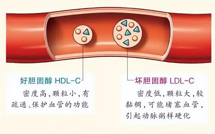 血脂高的人,如何提高血液中的“好胆固醇”?4个方法,不妨一试
