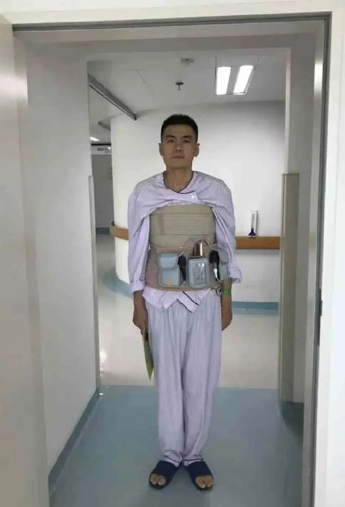 手术成功后的王十七