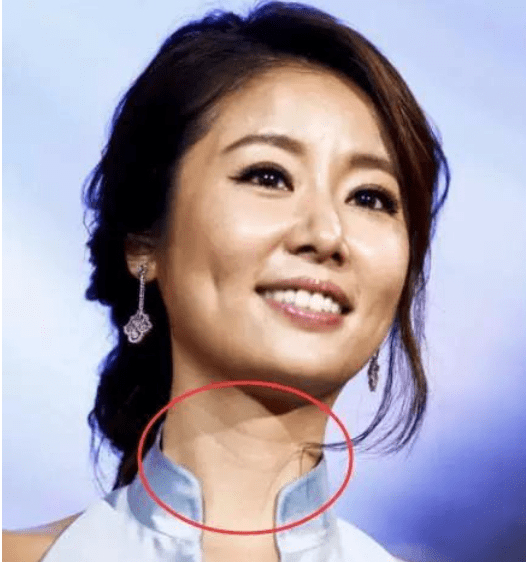 霍建华近照眉毛稀疏老态尽显,林心如也僵硬憔悴,这对夫妻怎么了?